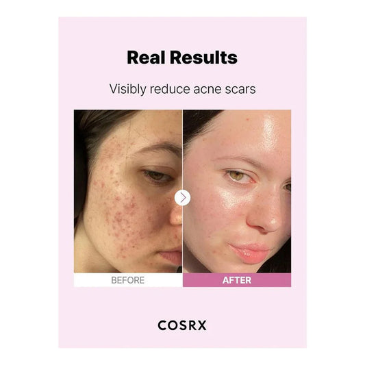 COSRX The Niacinamide 15 Serum - 20ml